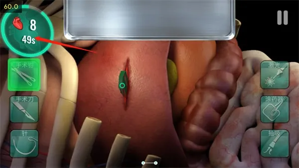 ҽԺ����ʱ��(����ģ����Ϸ)